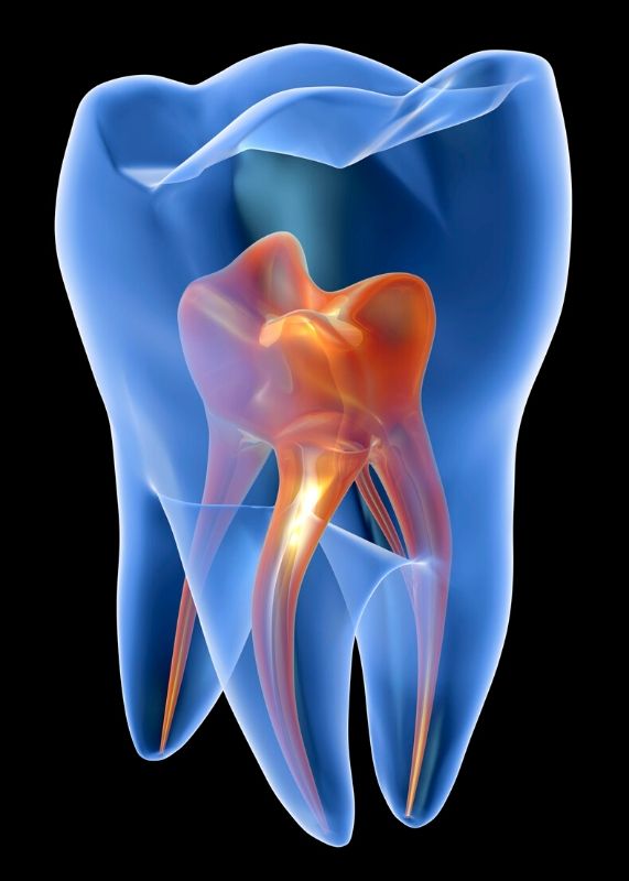 One of the main causes for toothaches and tooth pain is the presence of cavities or abscesses.